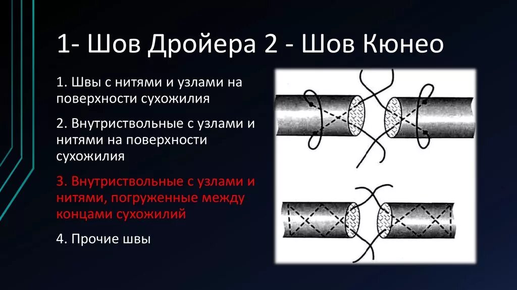 Шов 9. Техника наложения шва по кюнео. техника сухожильного шва кюнео. шов кюнео сухожилие. сухожильный шов по кюнео.