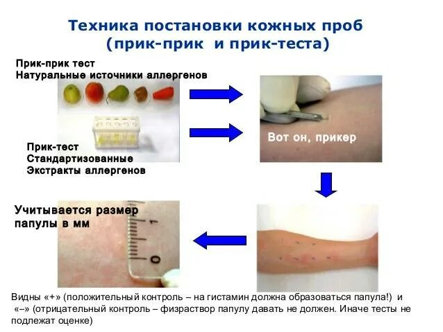 Оценка результатов кожно аллергической пробы. Кожные пробы на аллергены реакция. Методика проведения кожно-аллергической пробы. Методика постановки кожных аллергических проб. Фиксированная проба