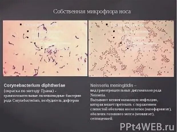 Микрофлора слизистых оболочек. Нормальная микрофлора носа. микрофлора органов дыхания. микрофлора полости носа. микроорганизмы, которые находятся в носоглотке в норме.