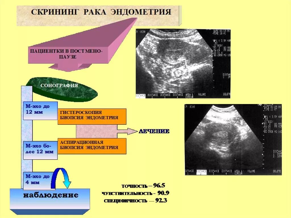 Симптомы рака эндометрия