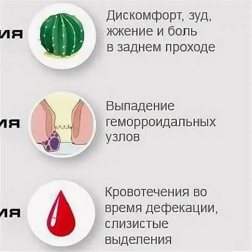 Почему не проходит геморрой при лечении. Признаки геморроя симптомы. геморрой причины симптомы.