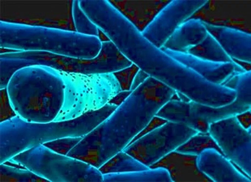 Новый вирус туберкулеза. Микобактерии сапрофиты. Возбудители микобактериозов.