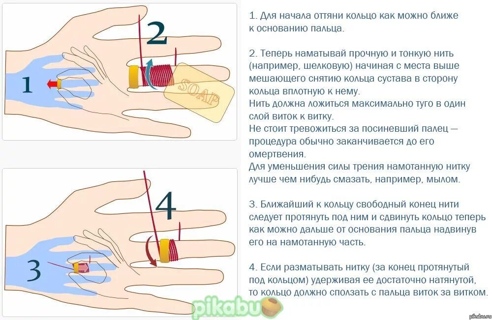 Как снять отечность рук в домашних условиях Отек палец как снять кольцо Shtampik.com