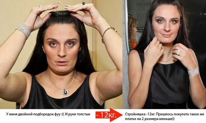 Ваенга фото до и после пластики