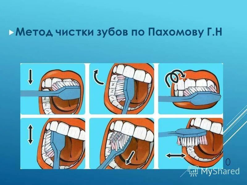 Стандартный метод чистки зубов (Пахомов г.н.). Метод Пахомова чистка зубов. Алгоритм чистки зубов.