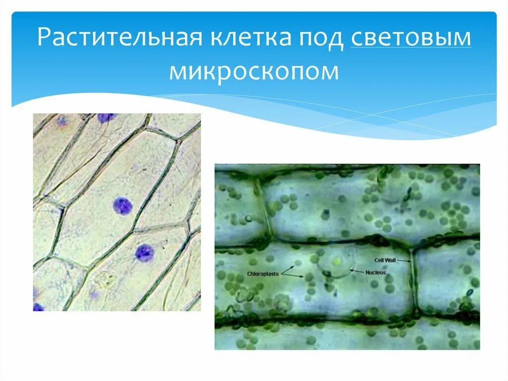 Увиденное под микроскопом растительной клетки. Клетка растения под микроскопом с подписями. кожица листа элодеи. строение растительной клетки под микроскопом. клетка растения в световом микроскопе.