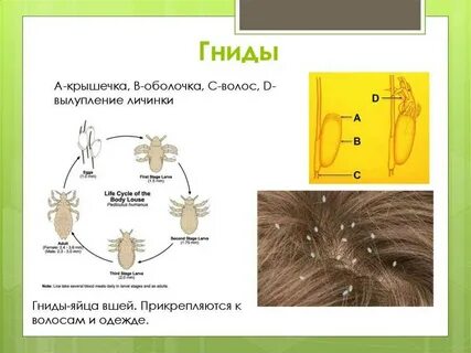 Вши яйцо гнида