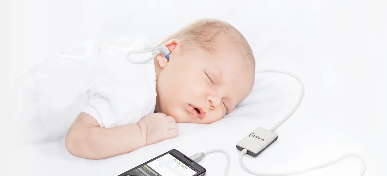Прибор отоакустической эмиссии. Аудиологический скрининг слуха у детей. Отоакустическая эмиссия (ОАЭ). Отоакустическая эмиссия у новорожденных. Аудиологический скрининг новорожденных.