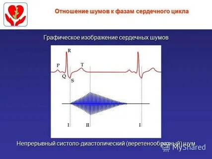 П шумов