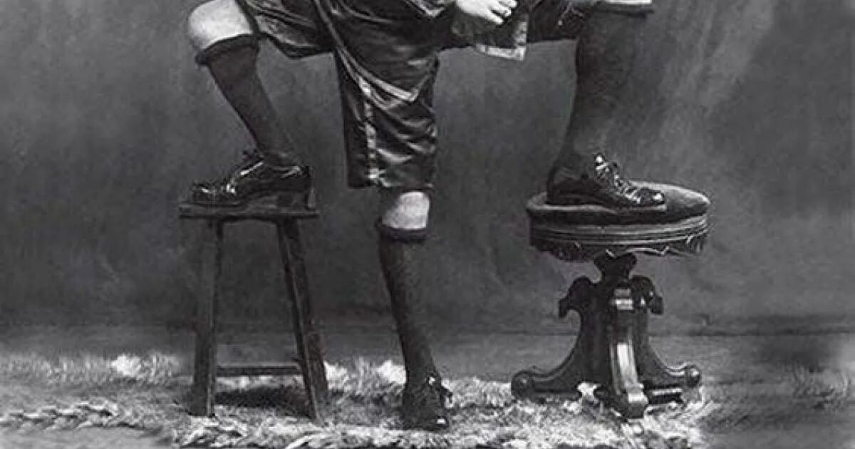 1889-1966. Франческо лентини. Франческо (фрэнк) лентини. Американец фрэнк лентини. Трёхногий фрэнк лентини.