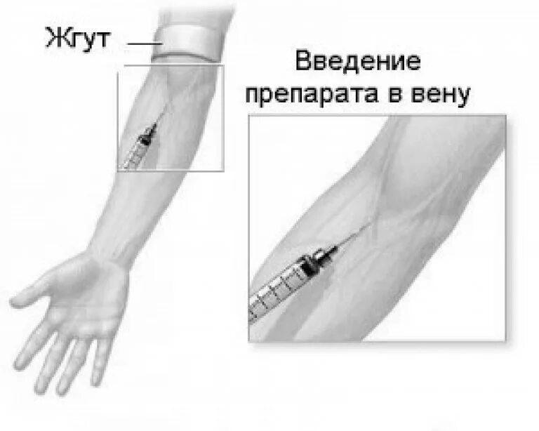 Вены локтевого сгиба для инъекции.