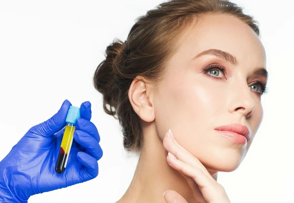 Плазма обогащенная тромбоцитами prp. Процедура prp. Плазмолифтинг (1 пробирка). Псаммотерапия. Плазмолифтинг в косметологии.