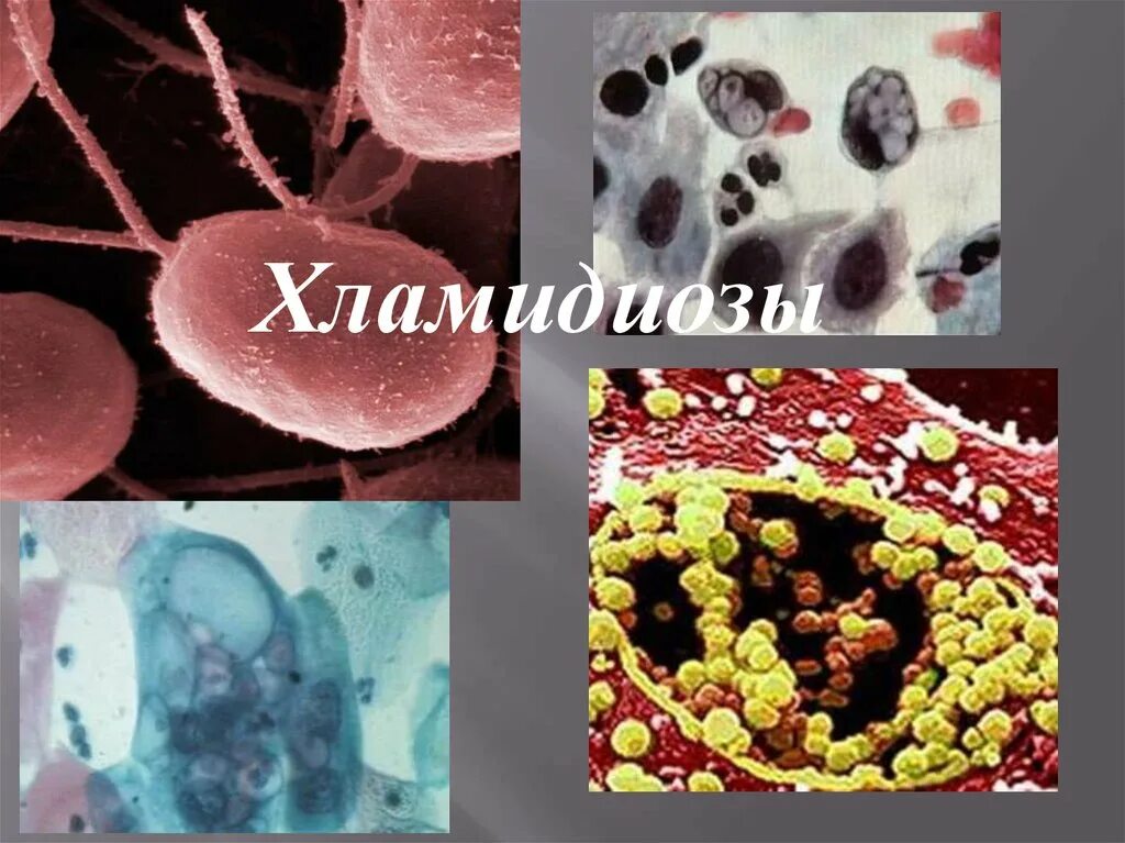 Хламидия chlamydia. Хламидиоз инфекционные болезни.