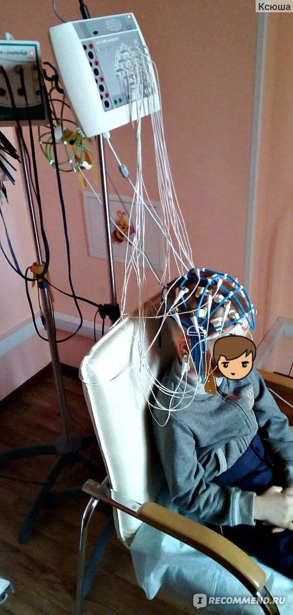 Как проходит энцефалограмма. Электрон энцефалограмма. ээг. ээг детям. ээг головного мозга.