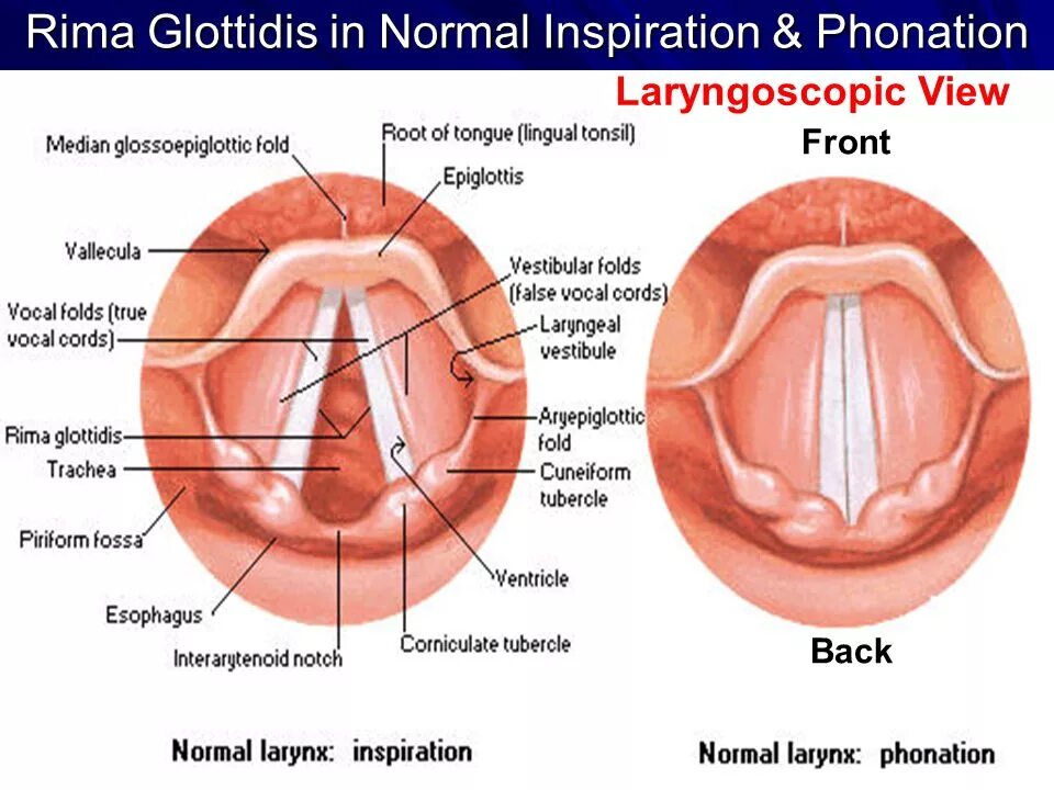 Лечение голосовых связок. Голосовая щель – Rima Glottidis. Голосовая складка латынь.