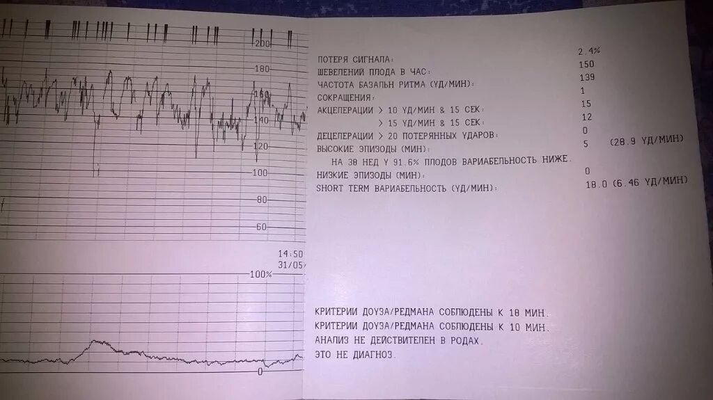 Схватки на 32