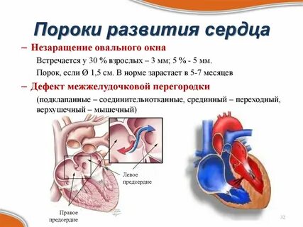 Порок 3 степени