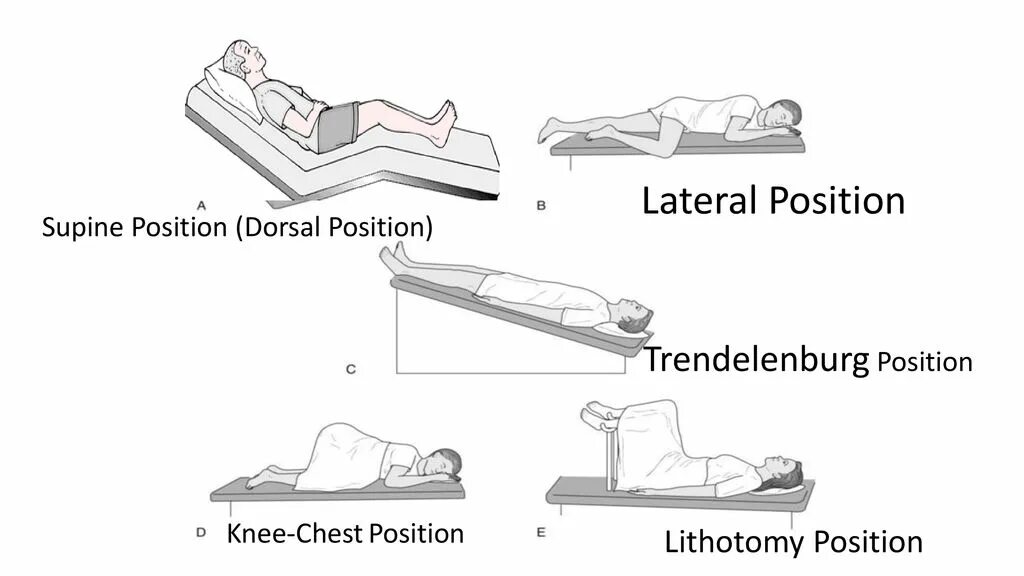 Ending position. Supine. lithotomy position. dorsal supine position. knee chest position.