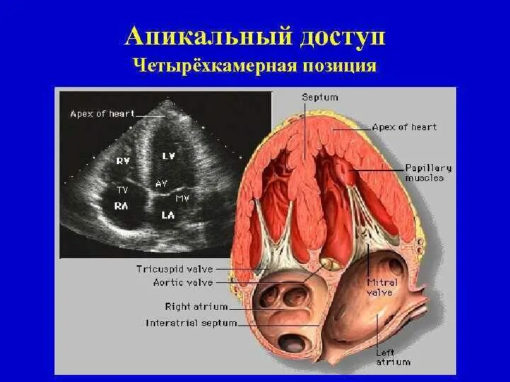 Четырехкамерный срез сердца. ЭХОКГ В 4 камерной позиции. Верхушечный доступ четырехкамерная позиция. ЭХОКГ апикальная четырехкамерная позиция. Апикальная четырехкамерная позиция сердца.