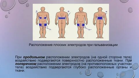 Методики гальванизации