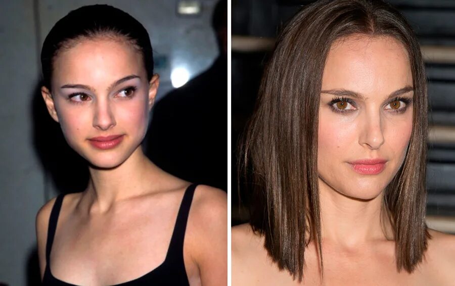 Натали портман после пластики. Натали портман ринопластика. Портман до и после пластики. Натали портман нос. Натали портман фото до пластики.