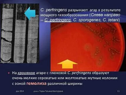 Газовая гангрена возбудители