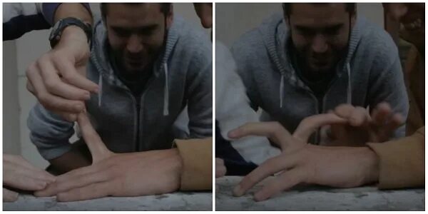 Как люди ломают руку. Безболезненно сломать руку. Повязка при закрытом переломе лучевой кости. Как люди ломают руку. Как люди ломают руку.