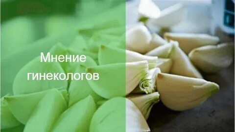 Мнение гинекологов