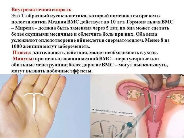 Спираль от беременности минусы. Спираль внутриматочная против беременности. Внутриматочная спираль метод контрацептива плюсы и минусы. Спираль внутриматочная минусы. Минусы спирали противозачаточной.
