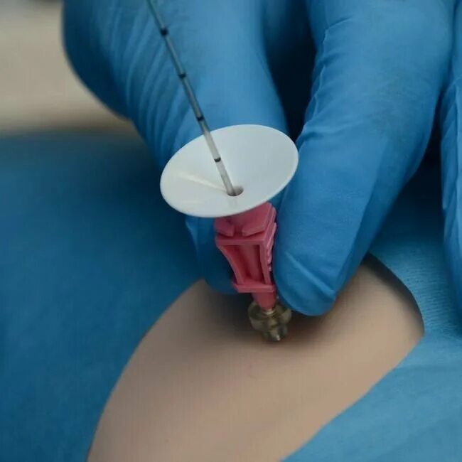 Сделать биопсию спб. Катетер внутривенный периферический. Тонкоигольная пункция щитовидной. Тонкоигольная биопсия молочной железы. Биопсия пункция предстательной железы.