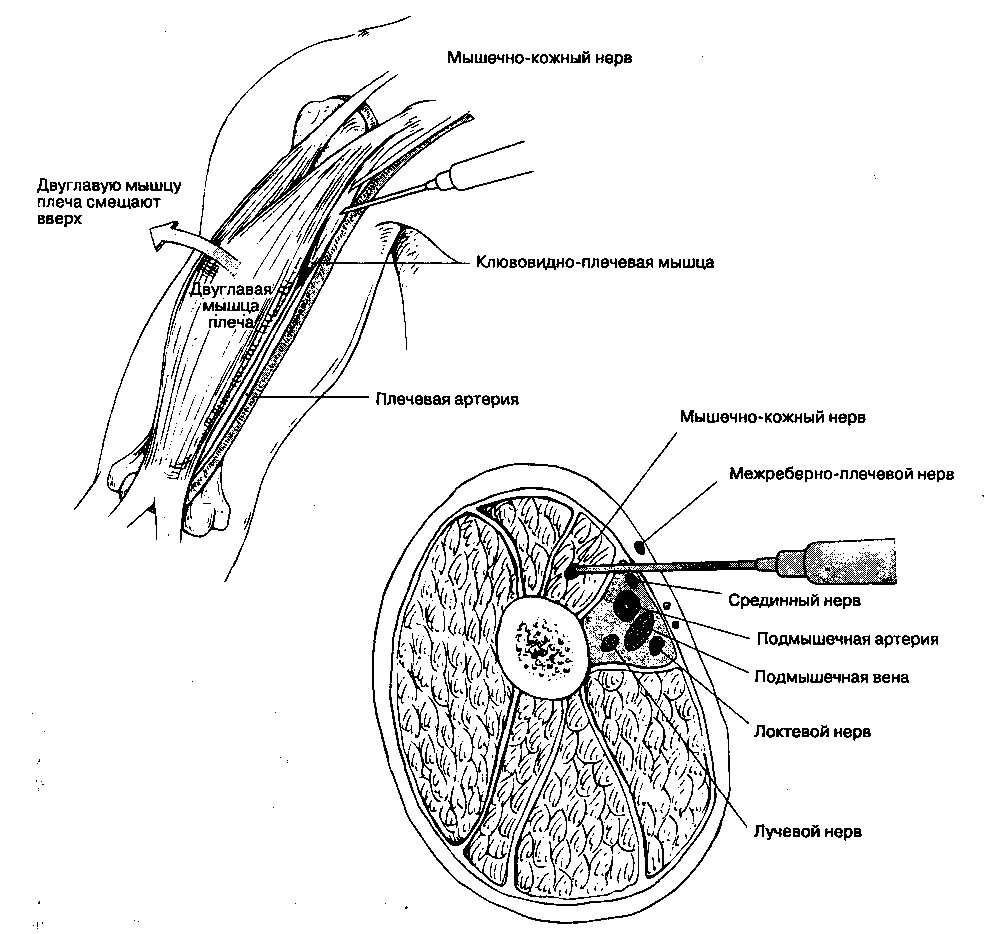 Кожно нервные. Мышечно кожный нерв предплечья. Блокада мышечно кожного нерва. Блокада медиального кожного нерва плеча. Мышечно-кожный нерв в области плеча.