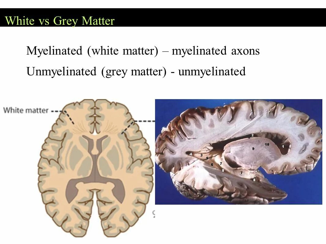 Grey matter. Grey matter and white matter. axons in white matter. grey matter(s). spongiform white matter.