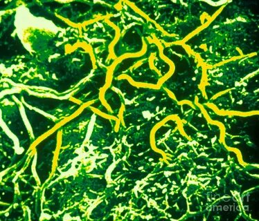Borrelia burgdorferi
