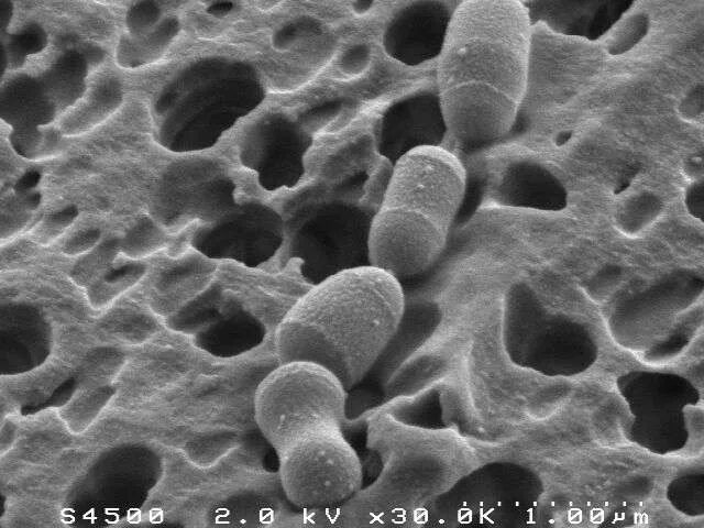 Бифидобактерии в кале. Бактероиды. Бактероиды морфология. Бактероиды (Bacteroides). Бактерии рода бактероидес.