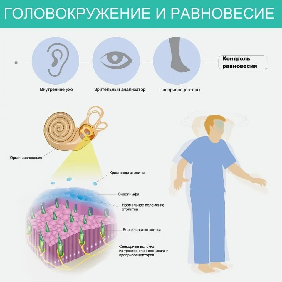 Кружится голова душно. Головокружение причины. Симптомы при головокружении. Физиологическое головокружение это. Кружение головы причины.