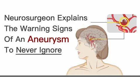 Warnings warn ignore