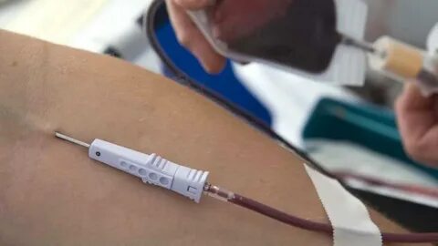 Сколько делают горячих уколов