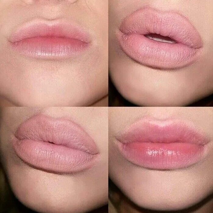 FULLIPS before &afters. PURCHASED NOW through our instagram at dollyMIXroxx Lip 
