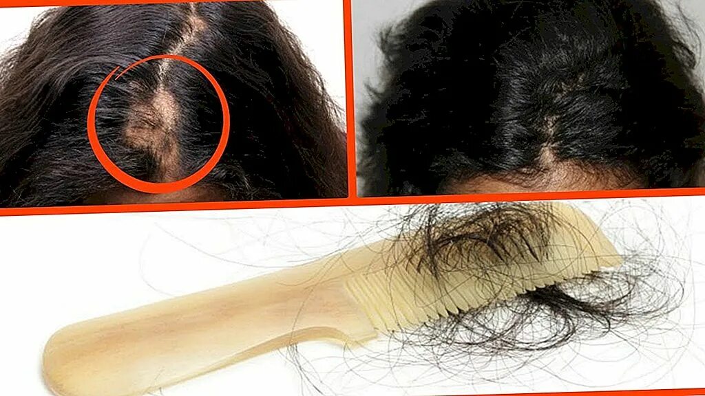 Усиление роста волос. Вырванные волосы вырастут. Вырастить длинные волосы быстро. Отросшие волоски на голове. Волосяные фолликулы выпадают.