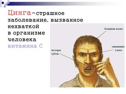 Болезнь моряков