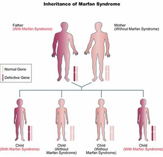 Related syndrome