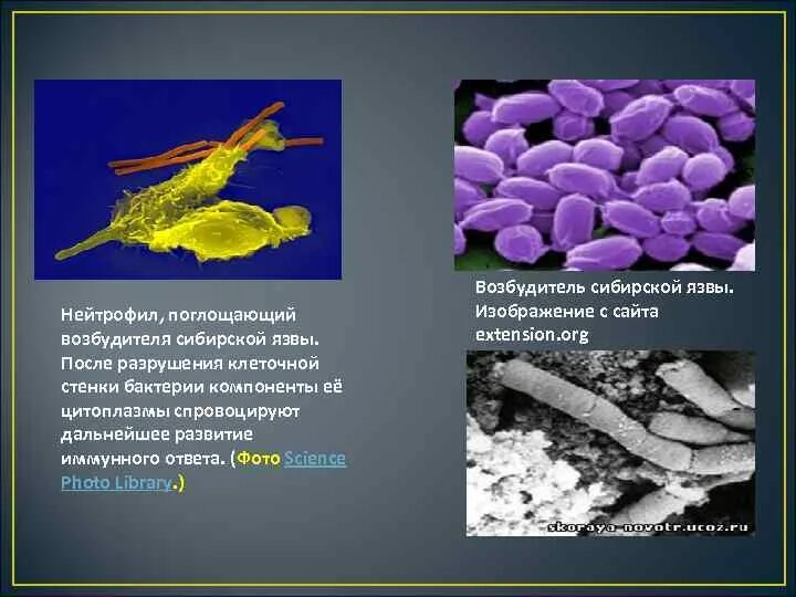 В скотомогильниках бактерии очень опасного заболевания. Сибиреязвенная бацилла микробиология. Сибиреязвенная палочка строение. Сибиреязвенная палочка микробиология.