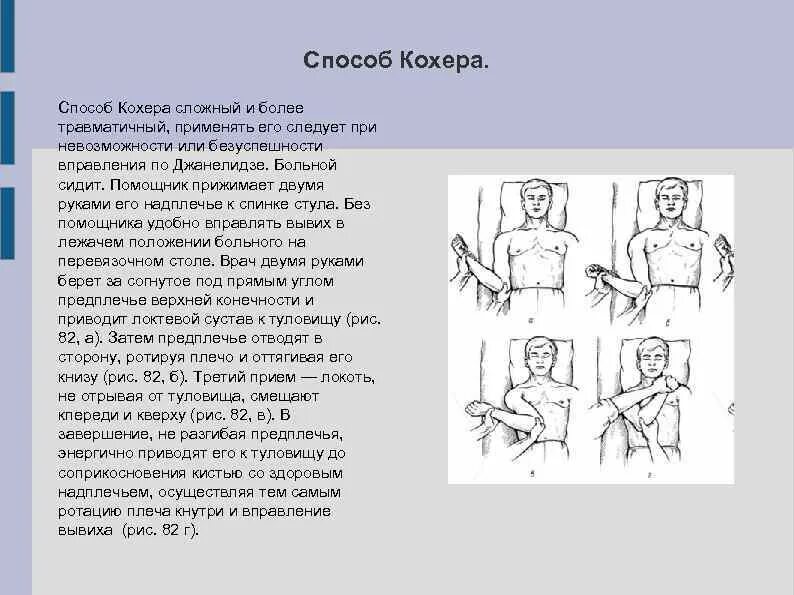 Лечение плеча после вправления. Методика вправления вывиха плеча. Метод вправления вывиха плеча по Кохеру. Вправление вывиха плечевой кости по Кохеру. Способ вправления вывиха по Кохеру.