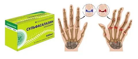 Кисти таблетки