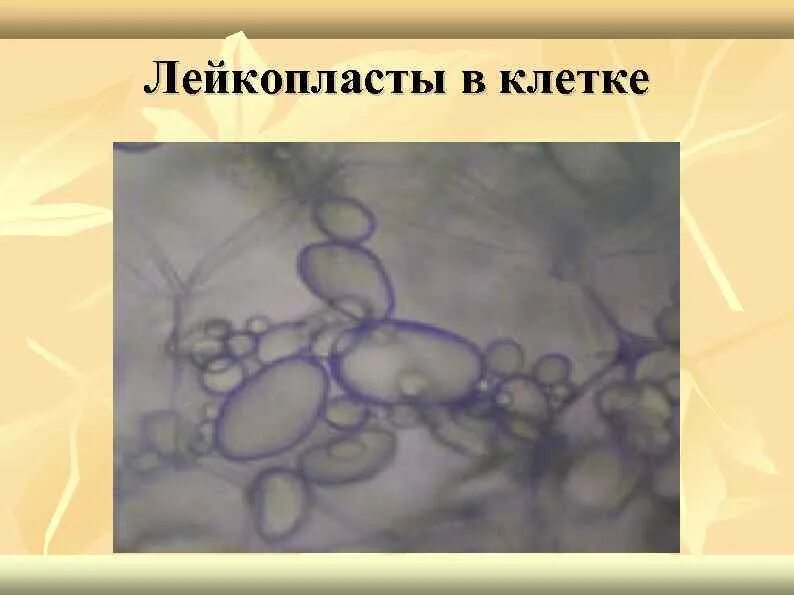 Лейкопласты клубня картофеля. Крахмальные зерна клубня картофеля под микроскопом. Лейкопласты под микроскопом. Крахмальные зерна под микроскопом. Лейкопласты в растительной клетке