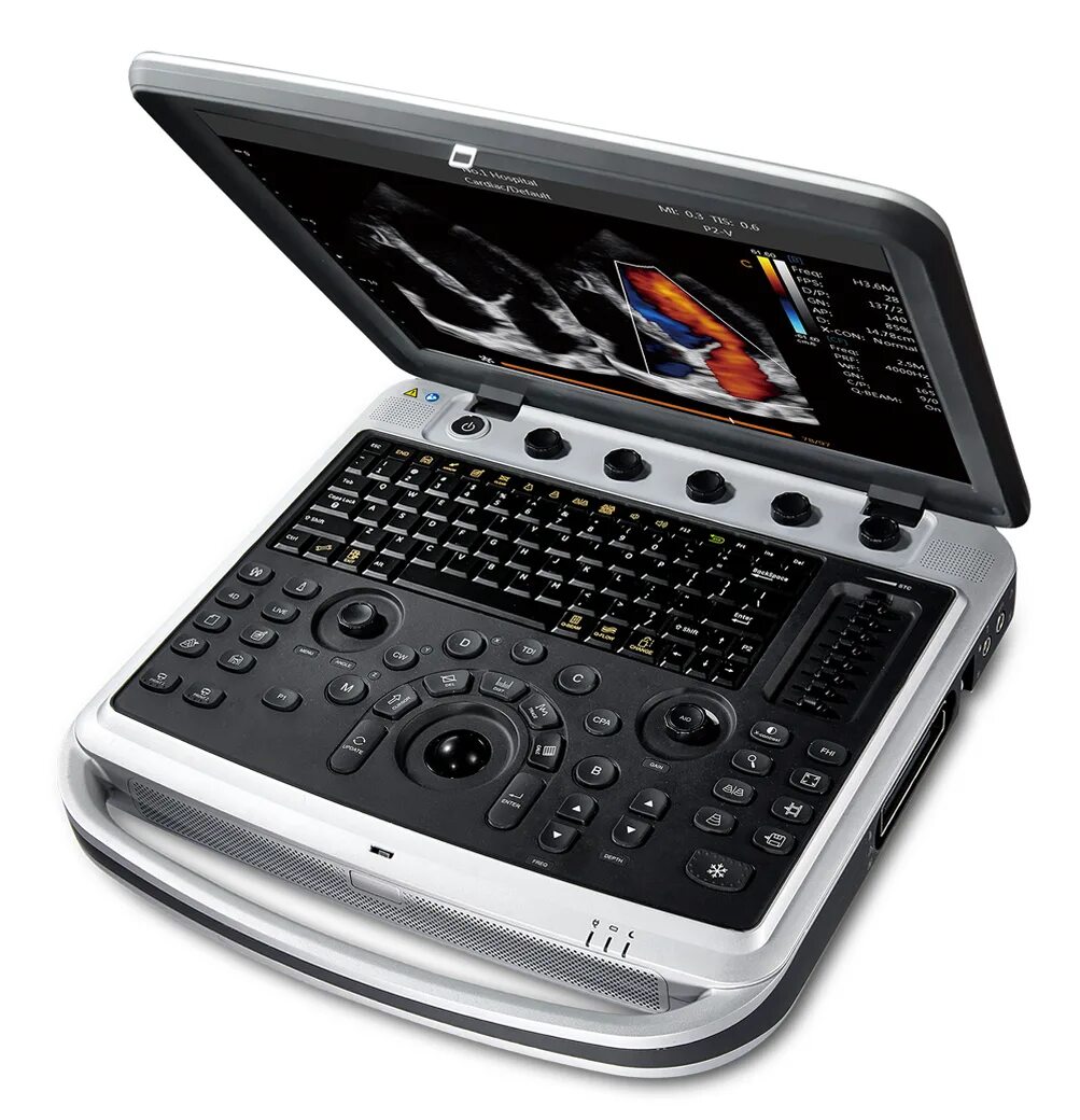 Chison sonotouch 80. Chison sonotouch 60. Chison sonotouch. Chison sonotouch 60. Chison sonotouch 60.