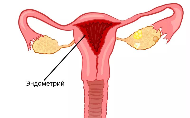 Слизистая матки отторгается