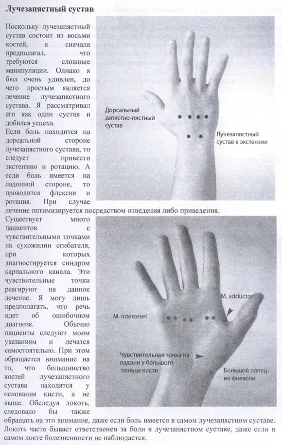 Почему болят суставы кистей. Боль в лучезапястном суставе. Болит рука в лучезапястном суставе. Болит кисть сустав запястья.