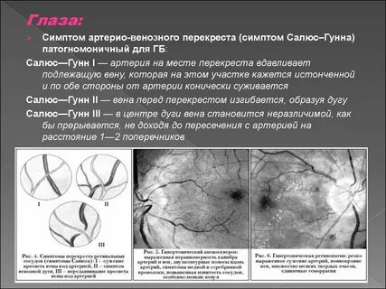 3 признака артерий