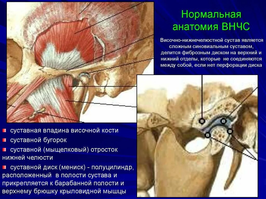 Соединение нижнечелюстной и височных костей. Синовиальная мембрана височно нижнечелюстного сустава. Нижнечелюстная ямка ВНЧС. ВНЧС сустав бугорок суставной. Верхнечелюстной сустав ВНЧС.